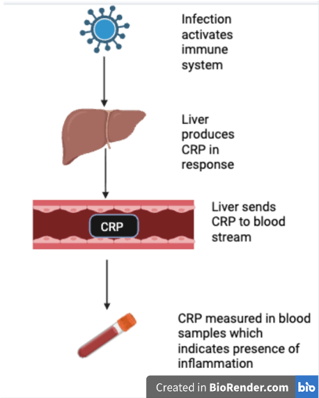 White background with four images, each representing a different aspect of C-Reactive Protein production and measurement. The first image is a blue circle with branch like extensions, the second is a liver, the third is a red triangle with a black oval representing CRP, the fourth is a vial filled with red.