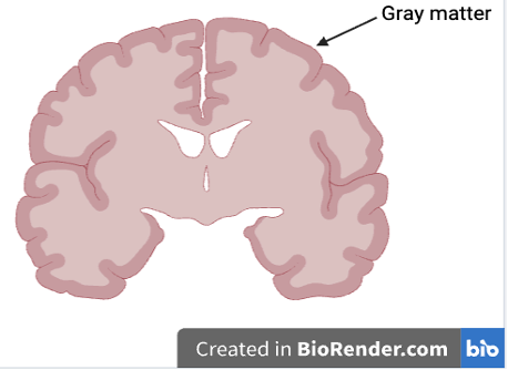 Image of a crescent-shaped light/dark pink brain slice cut vertically down the coronal plane. An arrow labeled 'gray matter' points to the outer, darker pink layer.