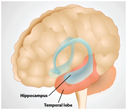 An image of the hippocampus in the temporal lobe.