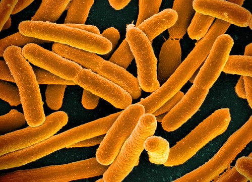 Orange E. Coli bacteria